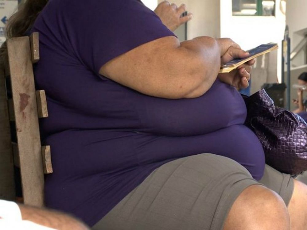 Dia Nacional de Preven��o da Obesidade: postos de sa�de do DF ajudam a enfrentar problema